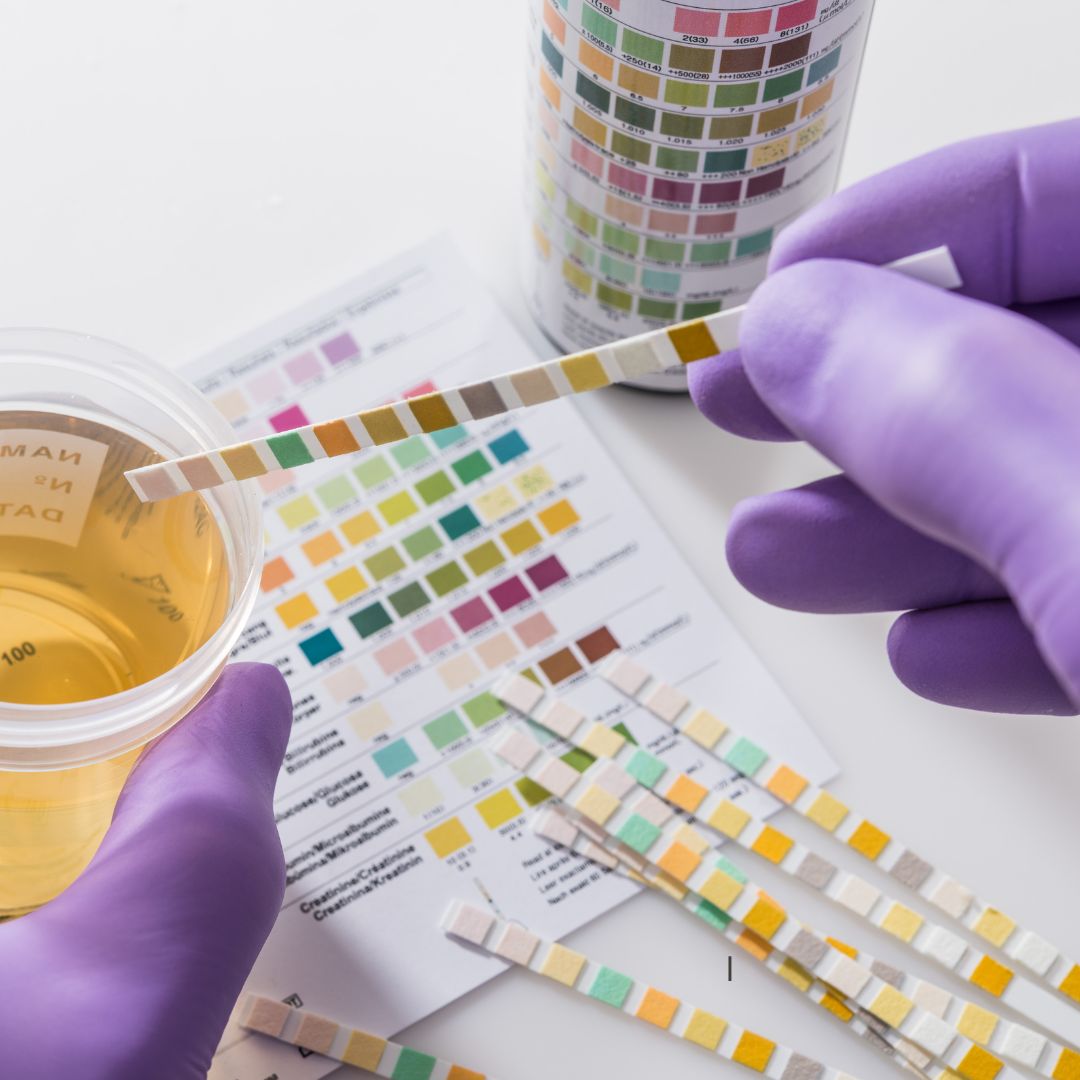 Urine wellness analysis health screening test sample diagnostic strip Radiant Revive Holistics